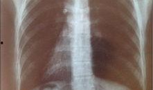 胸片爆料2025年最新版,揭示未来医疗影像技术新趋势